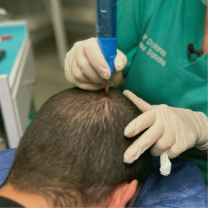 CURSO DENSIFICACIÓN CAPILAR | TRICOPIGMENTACIÓN