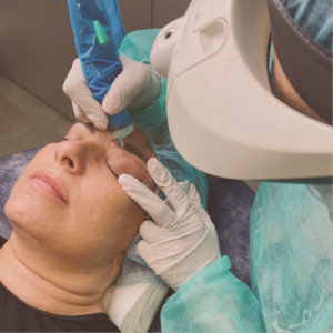 CURSO PEN GENERADOR DE PLASMA | FIBROBLAST
